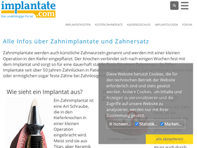 'implantate.com' screenshot