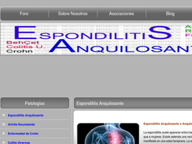 espondilitis.eu