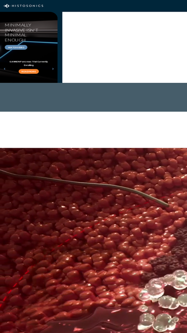 histosonics.com