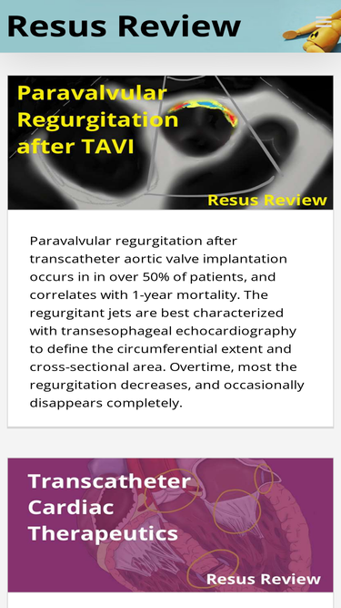 resusreview.com