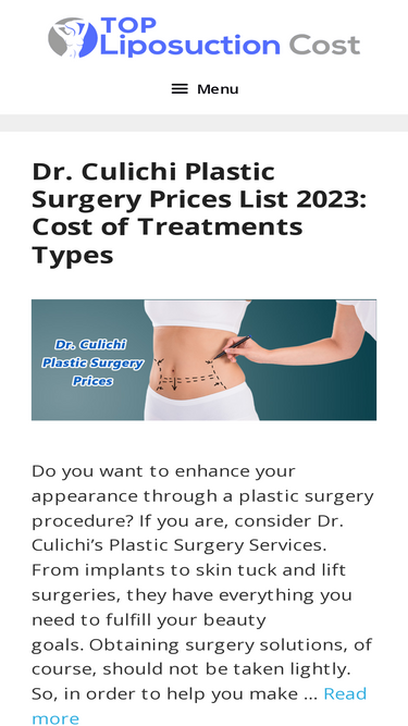 topliposuctioncost.com
